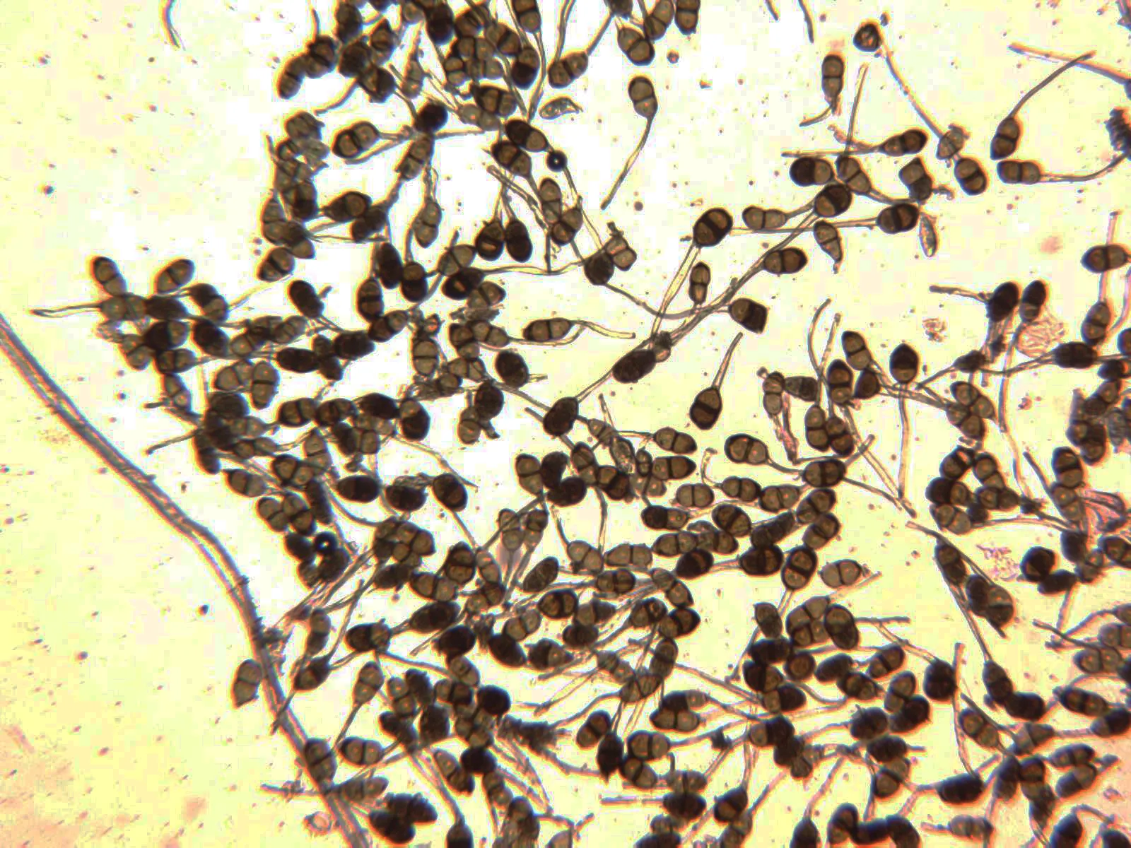 Microscopía de Puccinia jasmini - 23 - X 100